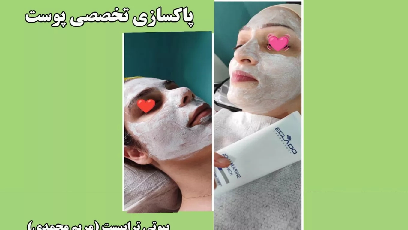 بیوتی تراپیست مریم اسکین کر و پاکسازی صورت در رشت
