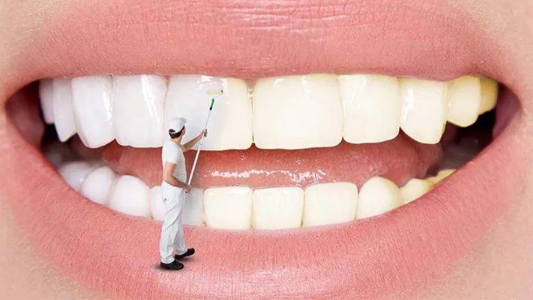 Causes of teeth discoloration