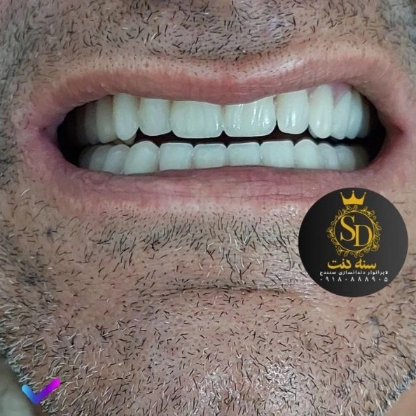 1710546582047.webp