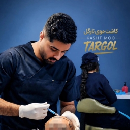 Targol hair transplant