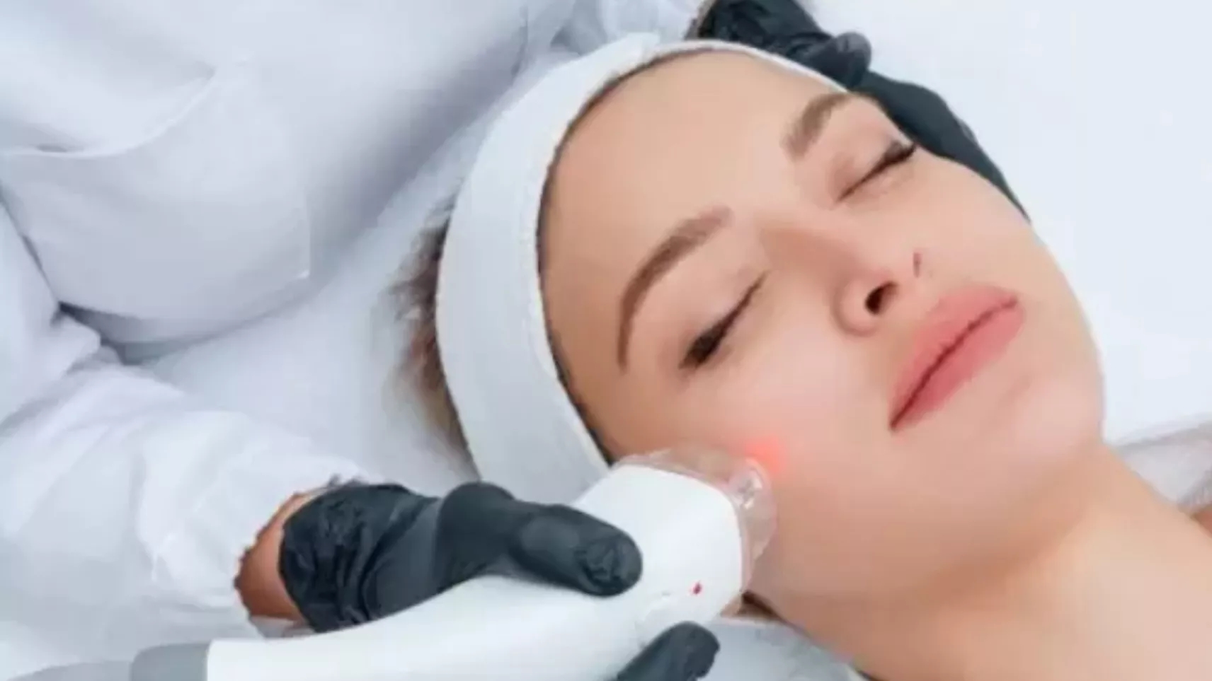 مقایسه دستگاه لیزر الکس دکا با نابلکس