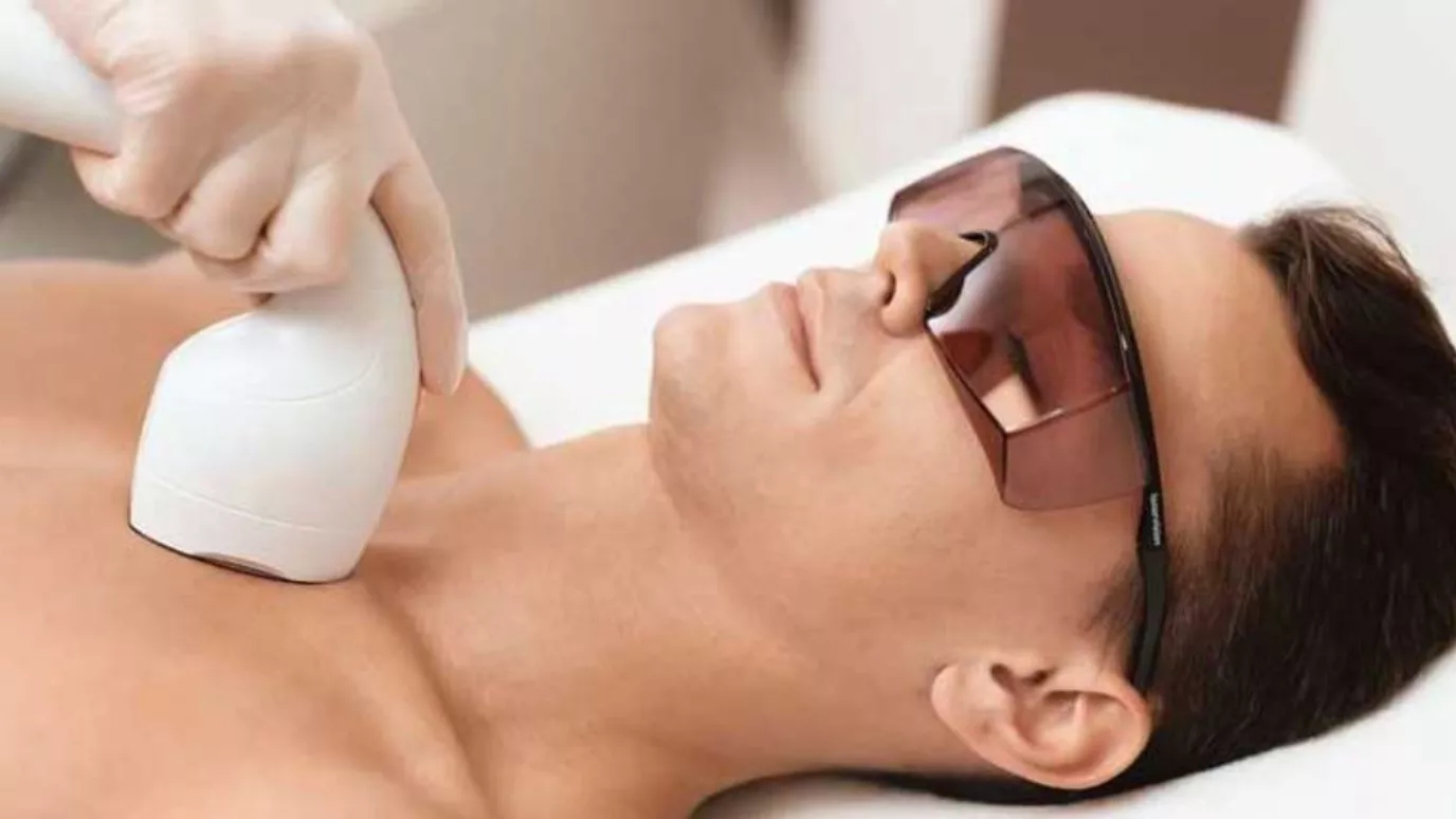 Laser hair removal is permanent