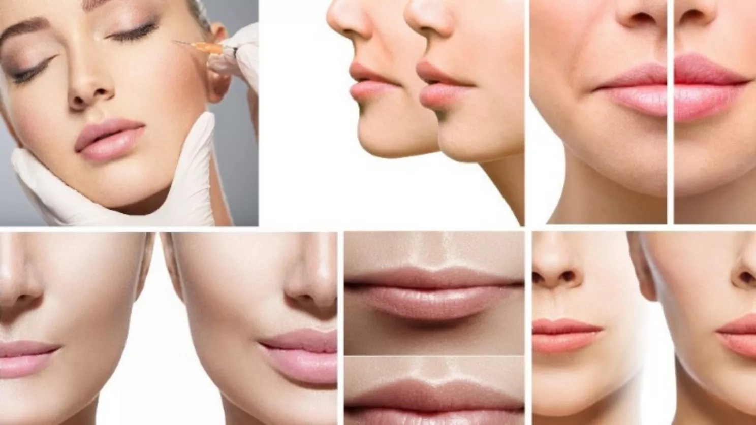 The effect of gel injection and botox injection in removing facial lines and wrinkles and their durability