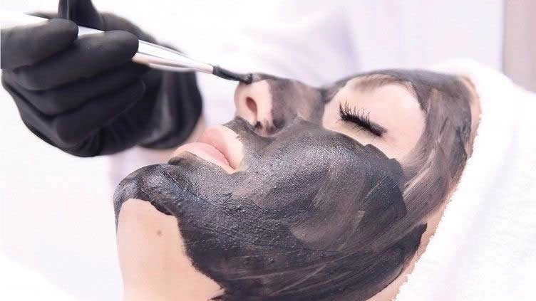 All about carbon peeling