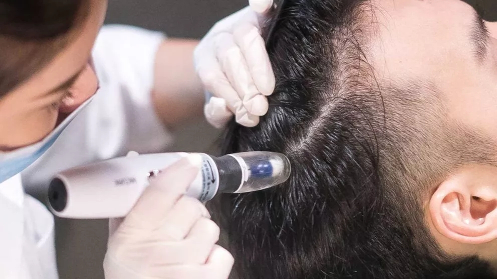 How is mesotherapy performed and with what materials?