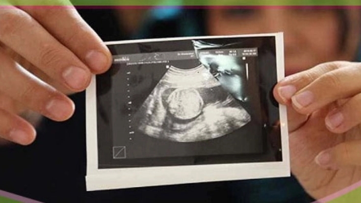Fetal screening ultrasound
