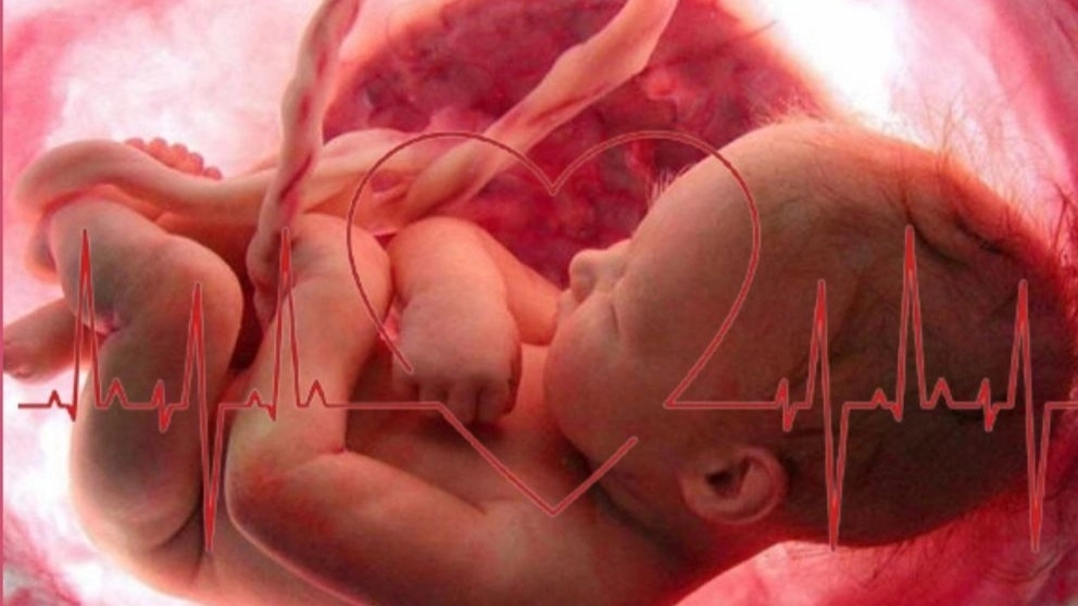Fetal ECG