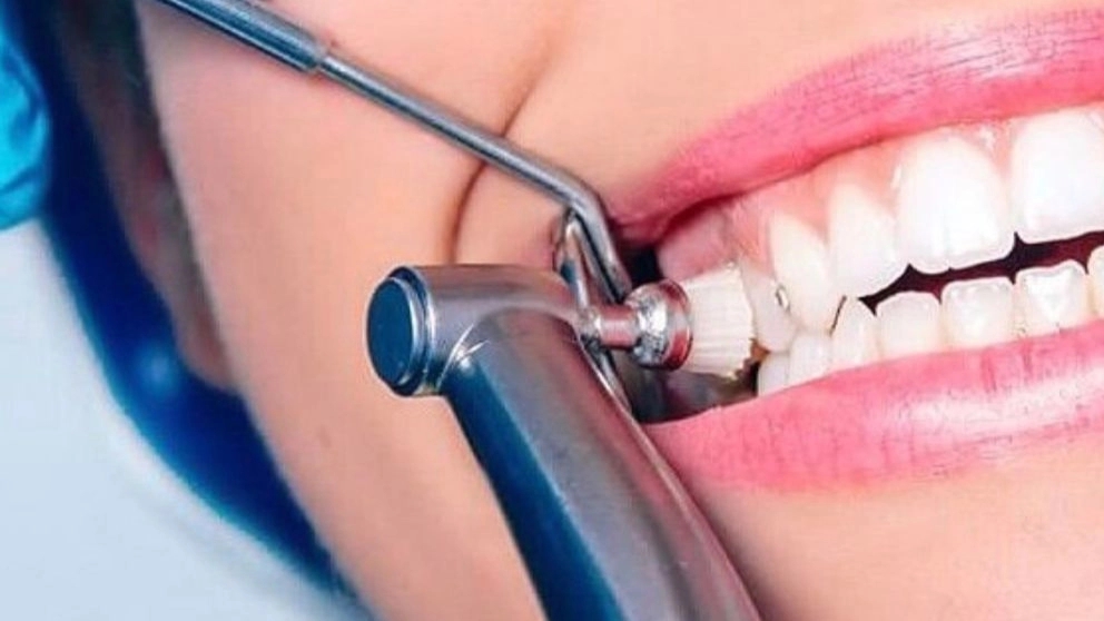 How to restore the beauty of your teeth?