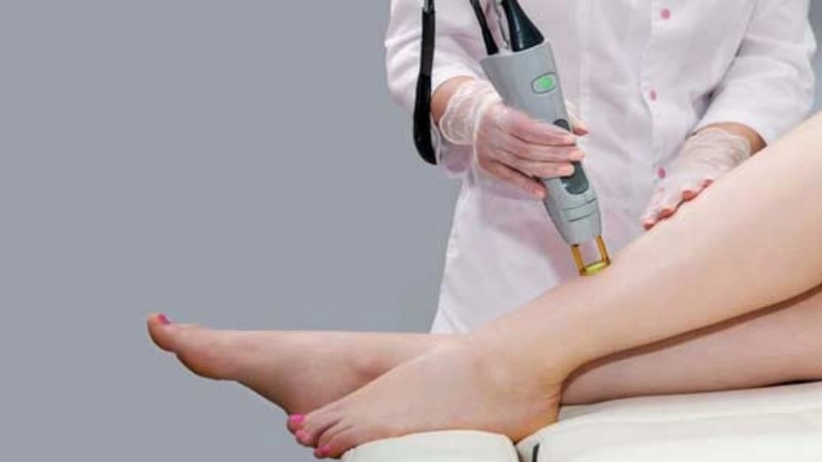 تمامی توضیحات مهم لیزر موهای زائد