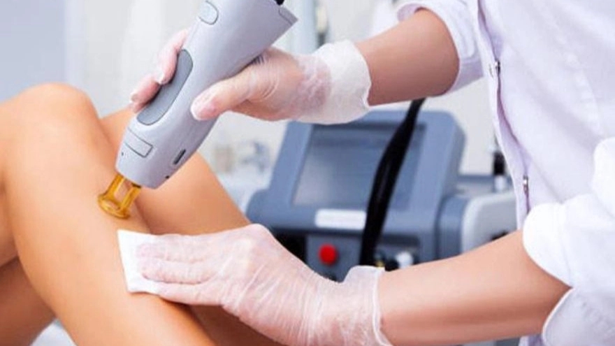 All important explanations of laser hair removal