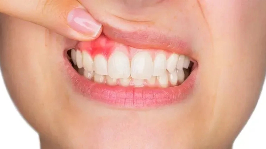 Toothache and 10 reasons for it