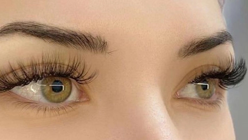 Hayden Nili eyelash implantation in Rasht
