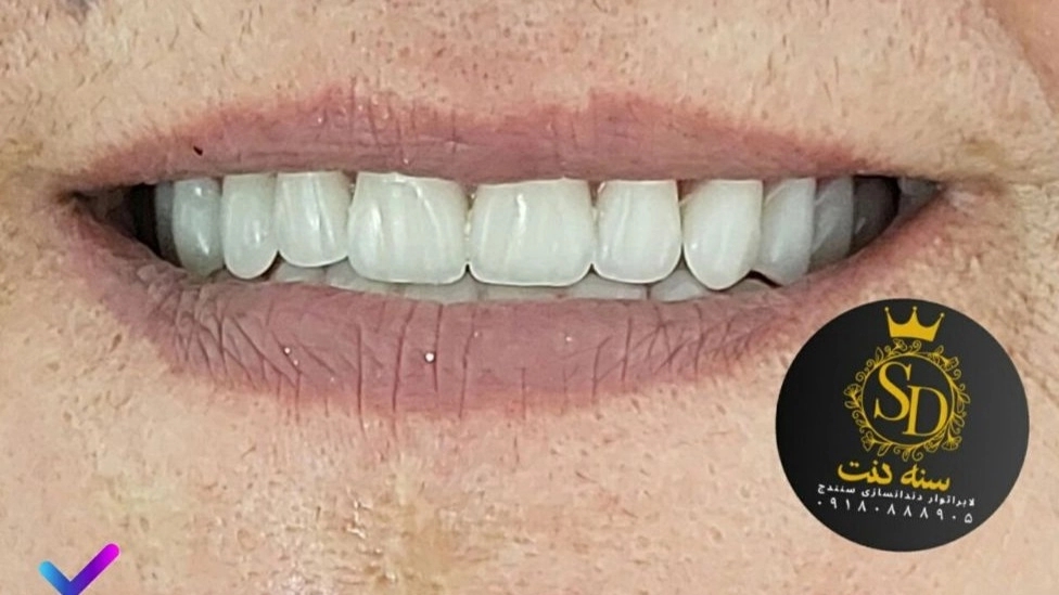 Sanedent dental laboratory in Sanandaj