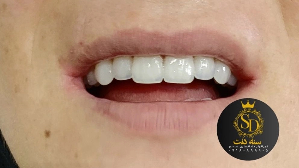 Dental rate in Sane Dent laboratory