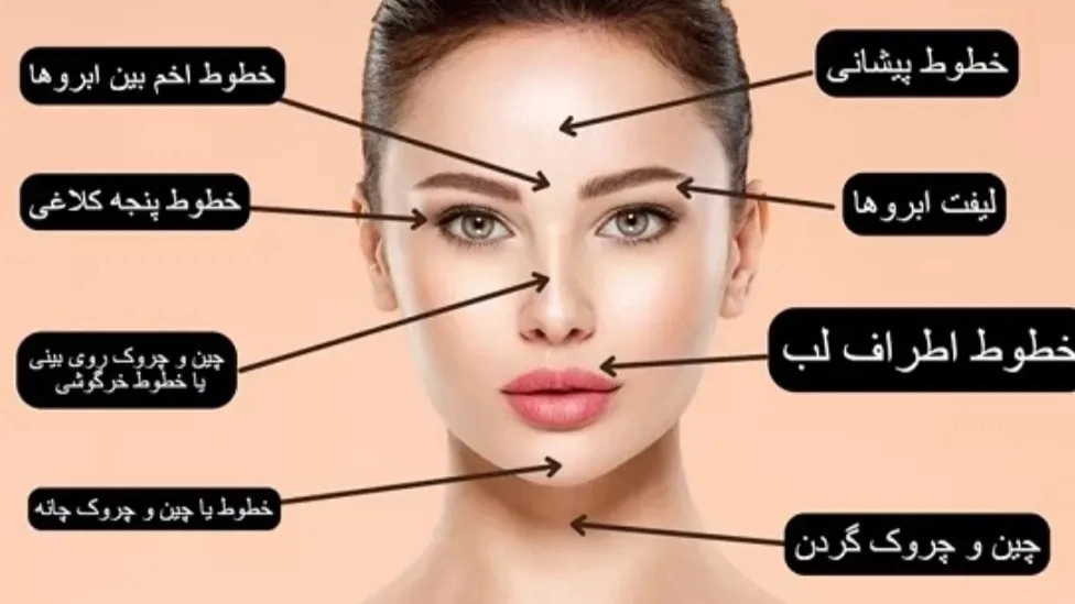 Important and necessary care after botox injection