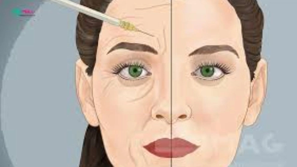 What is Botox? What are the benefits?