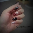 Manly nail implant 2019 in Mashhad