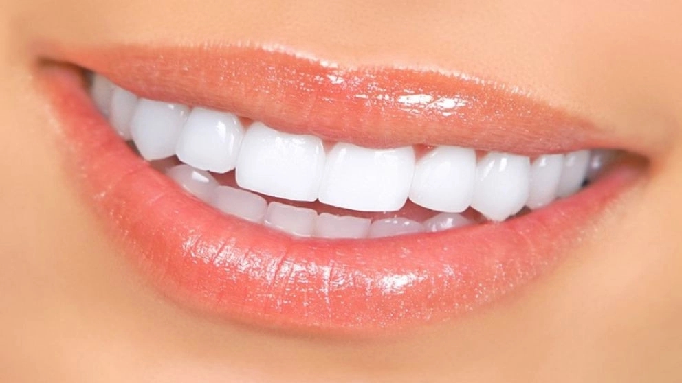 Teeth bleaching