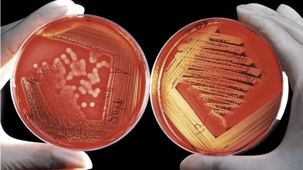 MERCK culture medium