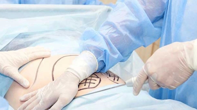 Dr. Ahmed Imani's beauty clinic, cosmetic surgery and body contouring in Sari, Mazandaran