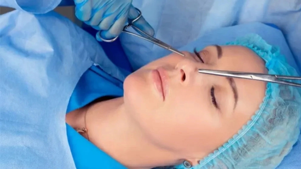 Effects of rhinoplasty