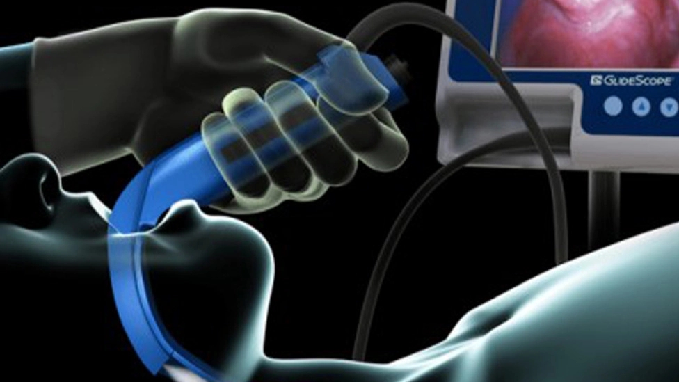 What is a laryngoscope?