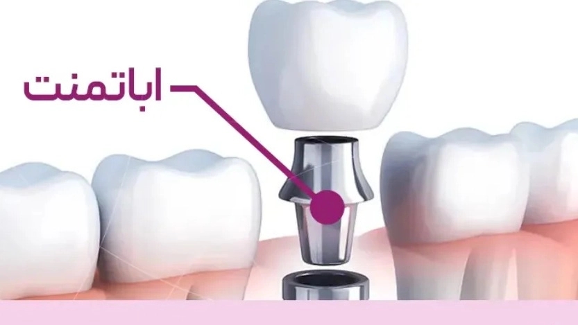 Ahvaz abutment