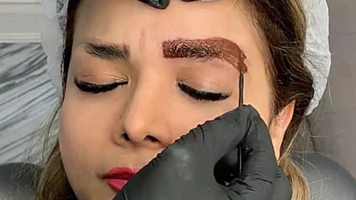 Remove the old tattoo in Haji Bekande