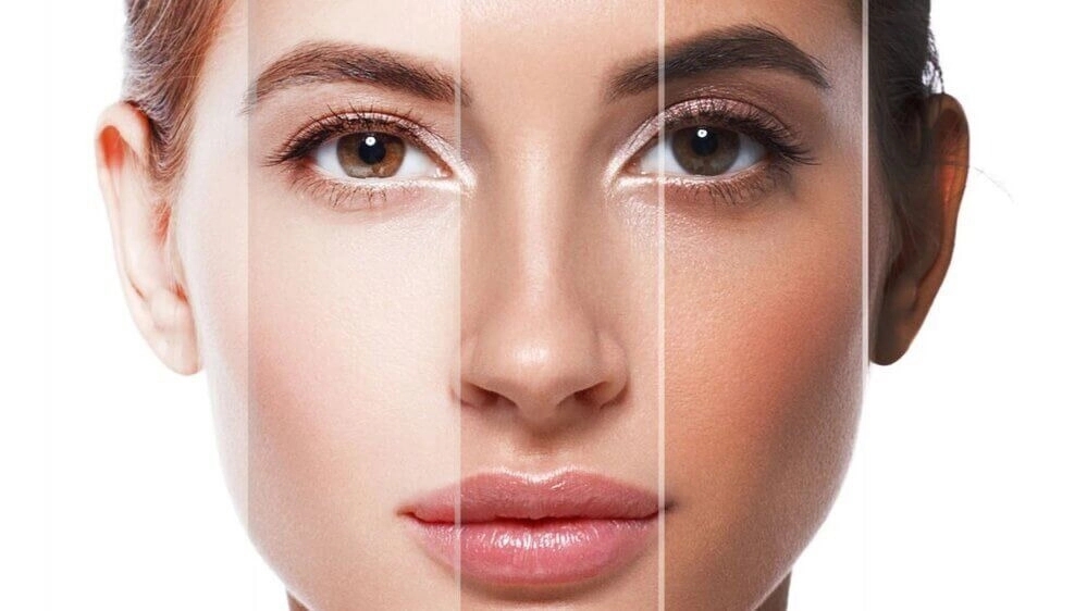 What factors determine your skin type?