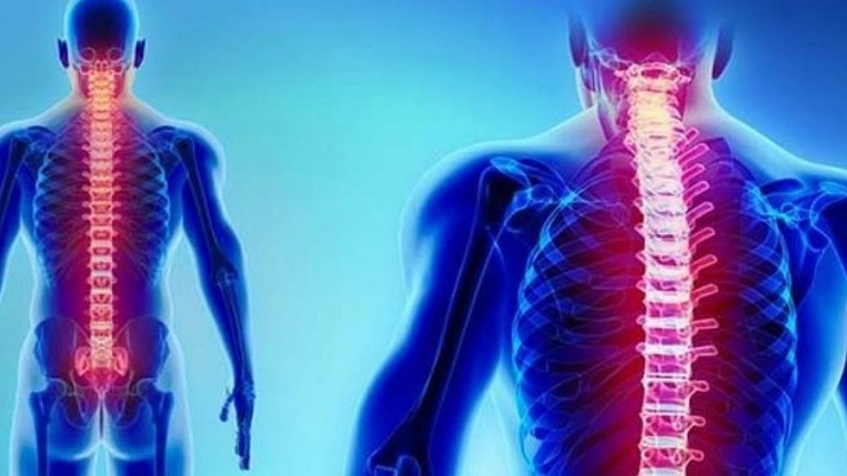 جراح ستون فقرات و فوق تخصص ارتوپدی در تهران