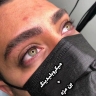 The Eyebrow Services of the King's World, Microbleeding Ben and Men's Lips Shid in Hamadan
