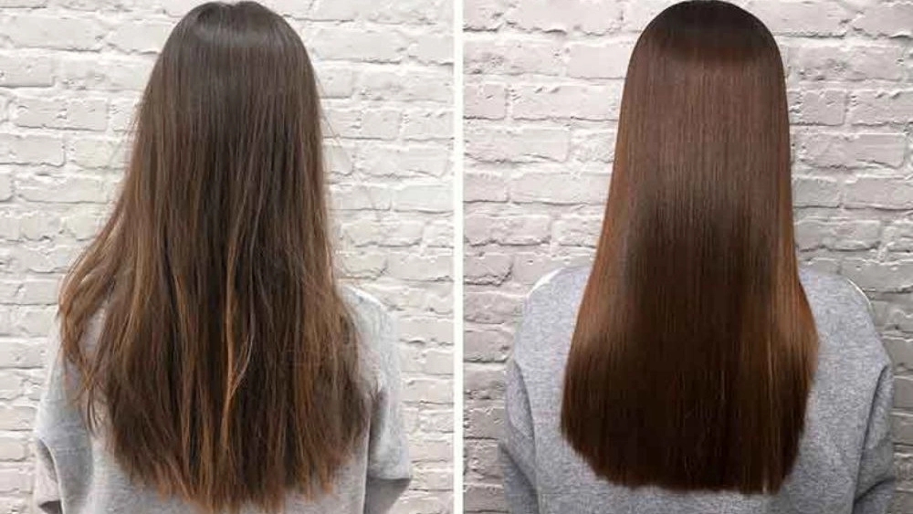 Keratin Zahra Nourollahi, Providing Reducation and Sleep Services of Scarb Scalp in Tehran