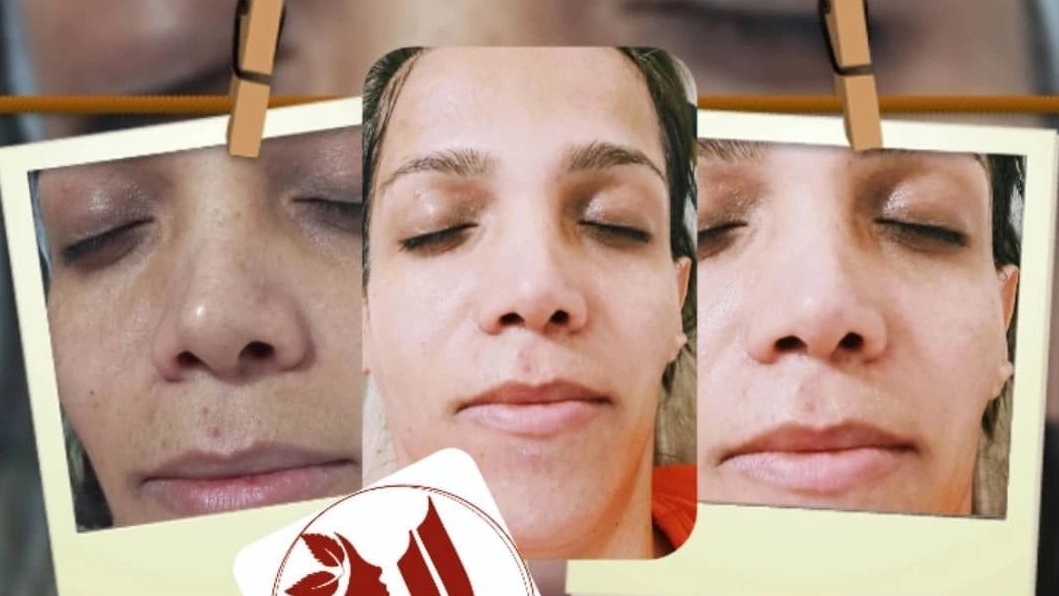 Specialized Services of Elie Skin Care and Treatment, Fisher Cleansing in Hamadan