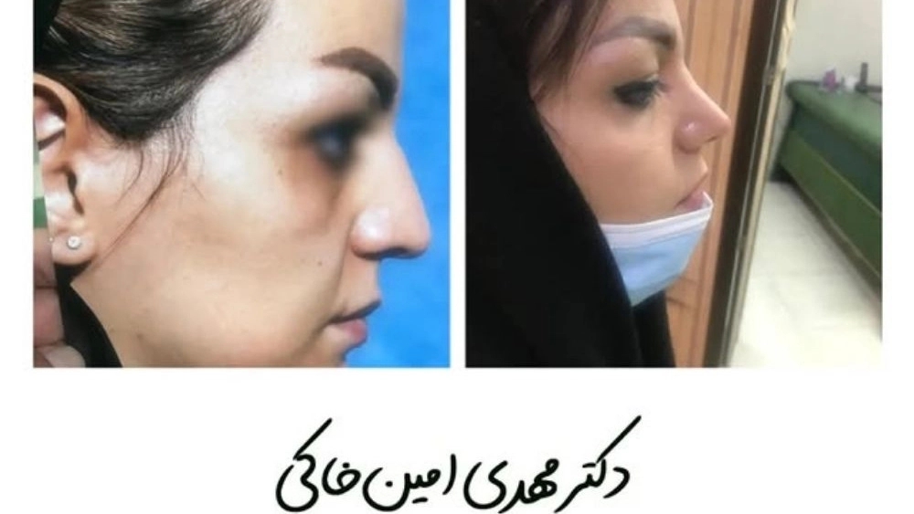 Dr. Mehdi Amin Khaki, plastic and cosmetic surgery specialist in Karaj