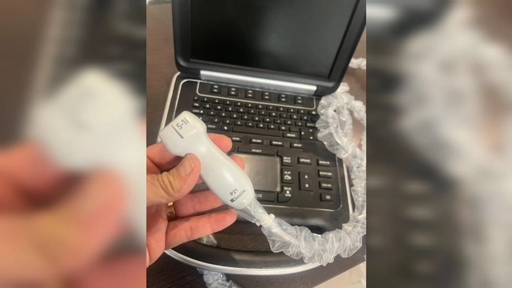 سونوگرافی و اکوکاردیوگرافی SonoSite