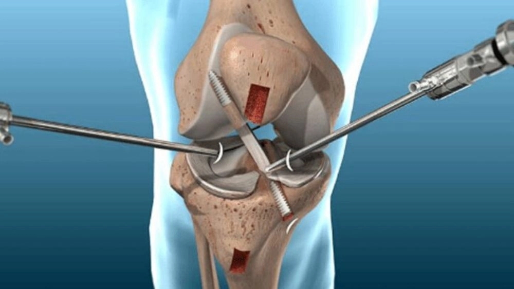 Wayan Ortho Clinic, Orthopedic services of foot scanning and making medical insoles in Tehran