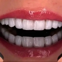 Salih Rezaei dental clinic, composite and cosmetic nerve repair services in Tabriz