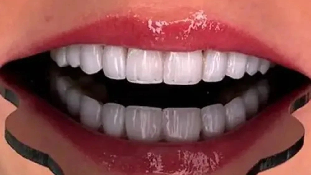 Salih Rezaei dental clinic, composite and cosmetic nerve repair services in Tabriz