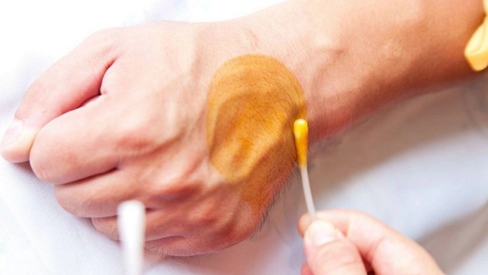 How to use betadine for wounds