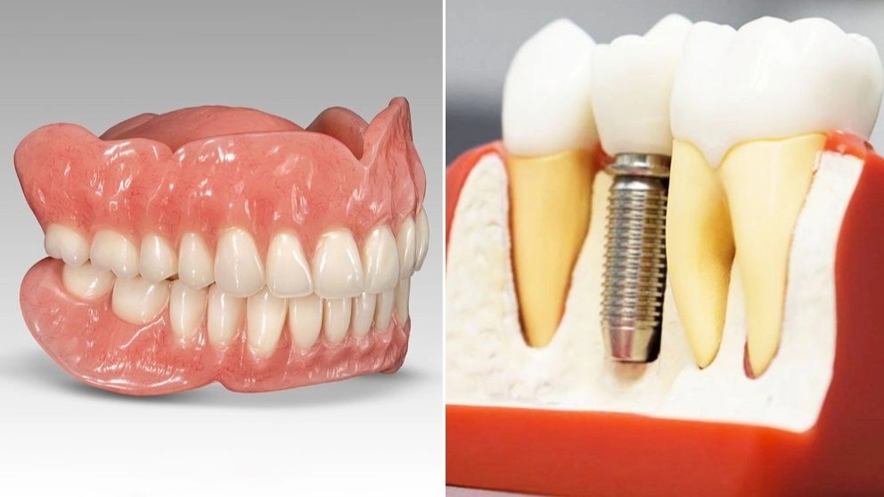 What is dental prosthesis?