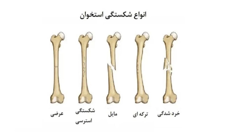 5 نوع کمک اولیه اضطراری