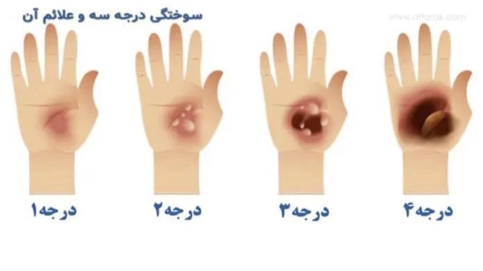 5 نوع کمک اولیه اضطراری
