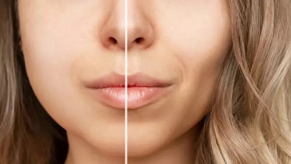 What is buccal?