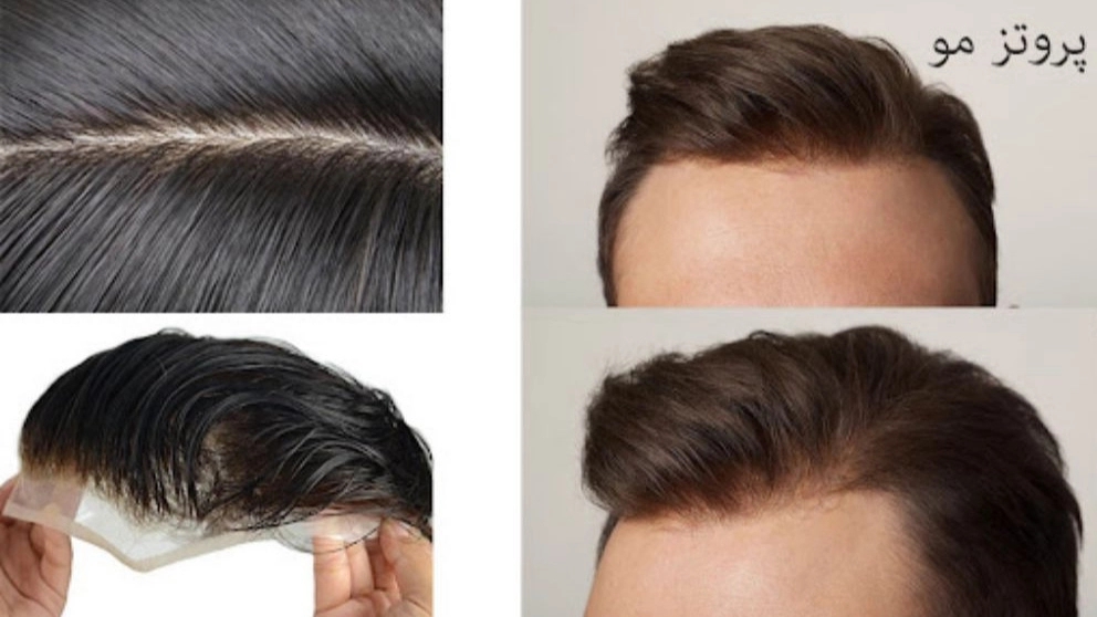 The difference between hair extensions and wigs