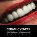 Dr. Fatemeh Mohammadi Dental Clinic, Laminate Implant in Isfahan