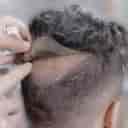 Mustafa Hami hair prosthesis in Sari