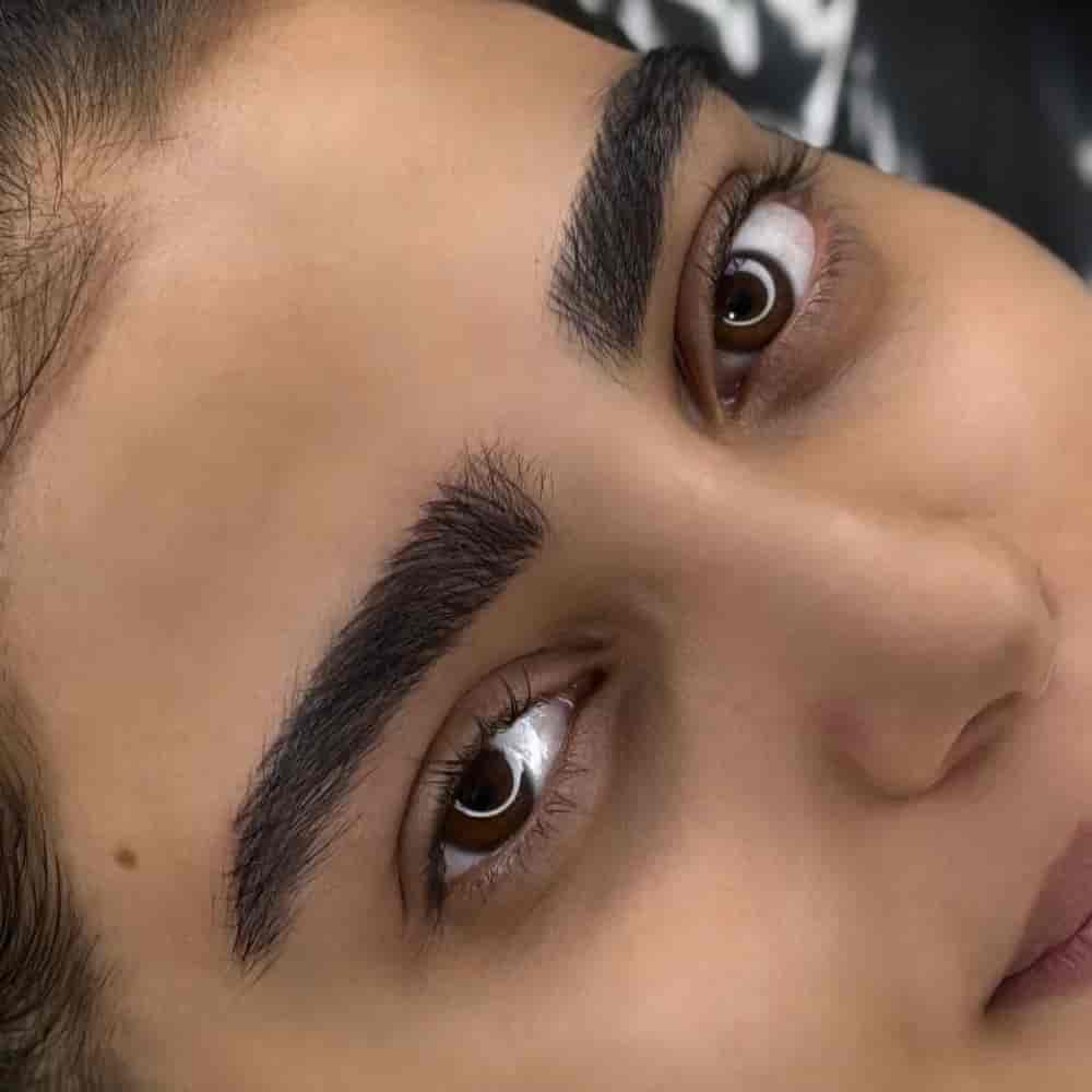 التليف الحاجب