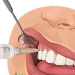 Hayan dental equipment, distribution of cartridge injection needles and gutta meta in Qom
