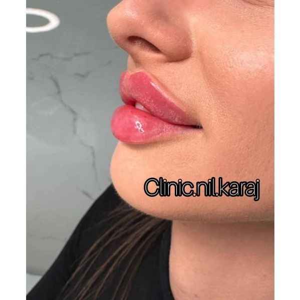 lips