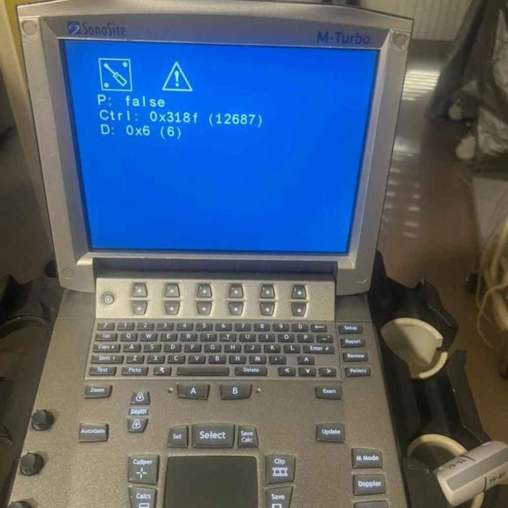 Specialized repair of the echocardiography machine